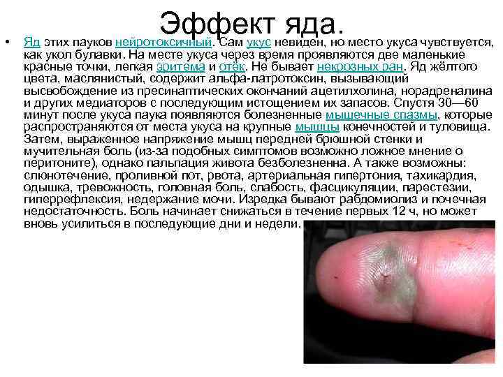  • Эффект яда. Яд этих пауков нейротоксичный. Сам укус невиден, но место укуса