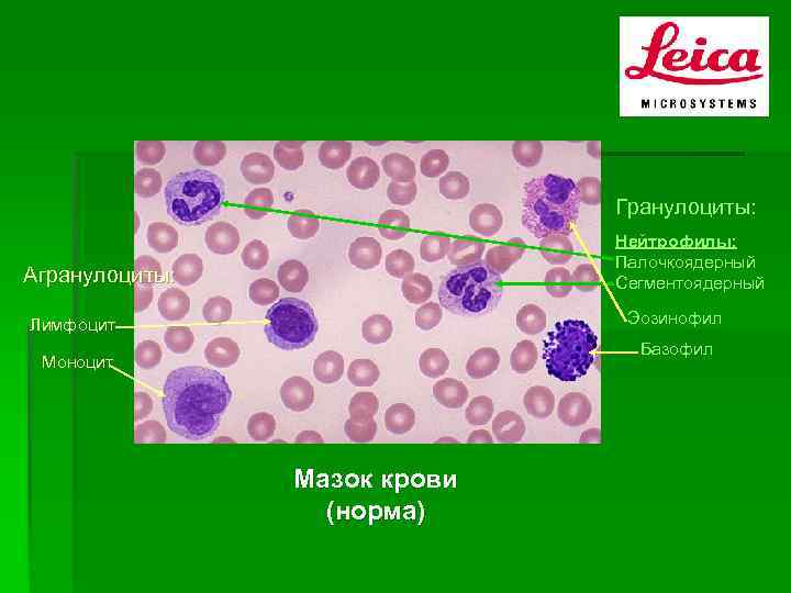 Сегментоядерные лимфоциты. Юный нейтрофил препарат. Мазок крови сегментоядерные. Базофильные палочкоядерные гранулоциты. Сегментоядерные нейтрофилы микро.