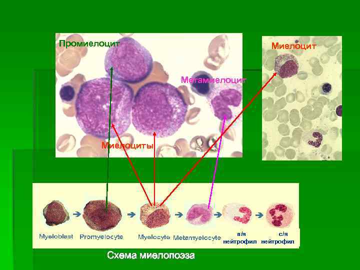 Нейтрофилы в костном мозге. Миелоциты и метамиелоциты в крови. Промиелоцит микроскопия. Промиелоцит ядро. Эозинофильный миелоцит.