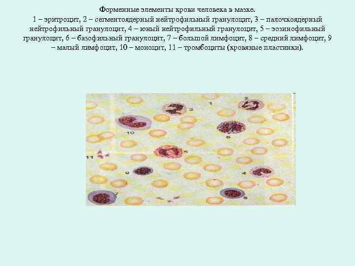 Форменные элементы крови человека в мазке. 1 – эритроцит, 2 – сегментоядерный нейтрофильный гранулоцит,