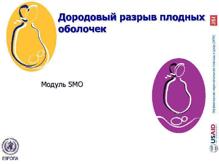 Модуль 5 MO Эффективная перинатальная помощь и уход (ЭПУ) Дородовый разрыв плодных оболочек 