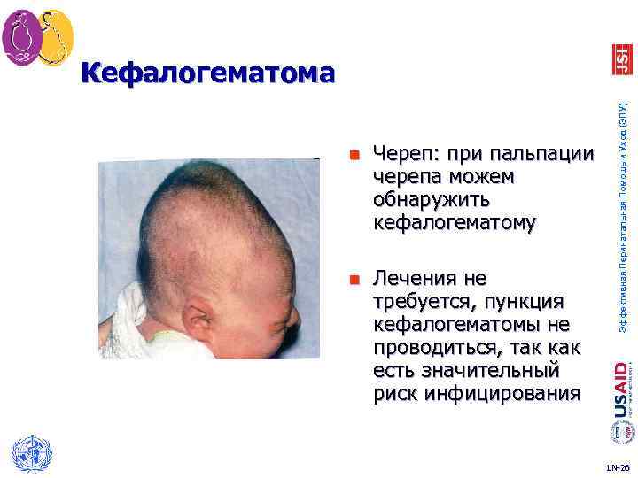 n Череп: при пальпации черепа можем обнаружить кефалогематому n Лечения не требуется, пункция кефалогематомы