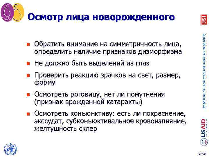 n Обратить внимание на симметричность лица, определить наличие признаков дизморфизма n Не должно быть