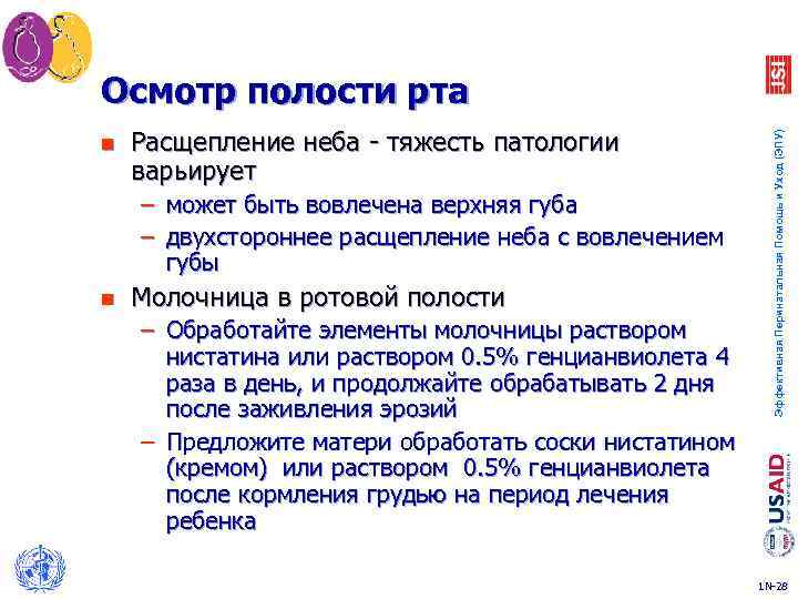 n Расщепление неба - тяжесть патологии варьирует – может быть вовлечена верхняя губа –