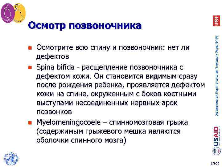 n n n Осмотрите всю спину и позвоночник: нет ли дефектов Spina bifida -