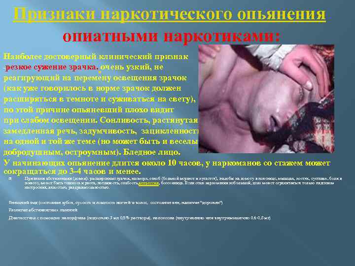 Признаки наркотического опьянения опиатными наркотиками: Наиболее достоверный клинический признак резкое сужение зрачка. очень узкий,