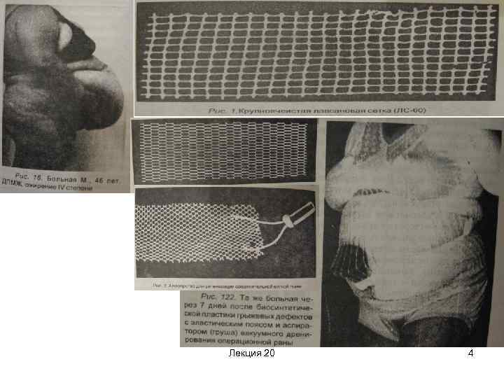 Лекция 20 4 
