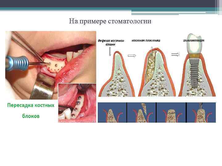 На примере стоматологии 