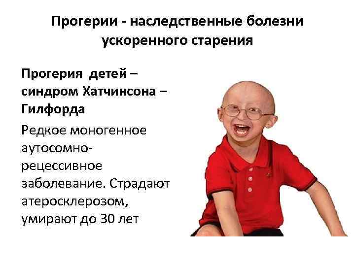 Прогерии - наследственные болезни ускоренного старения Прогерия детей – синдром Хатчинсона – Гилфорда Редкое