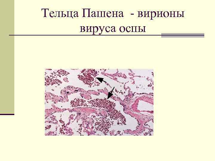 Тельца Пашена - вирионы вируса оспы 