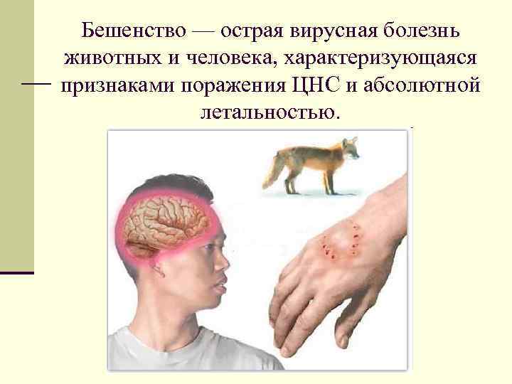 Бешенство — острая вирусная болезнь животных и человека, характеризующаяся признаками поражения ЦНС и абсолютной