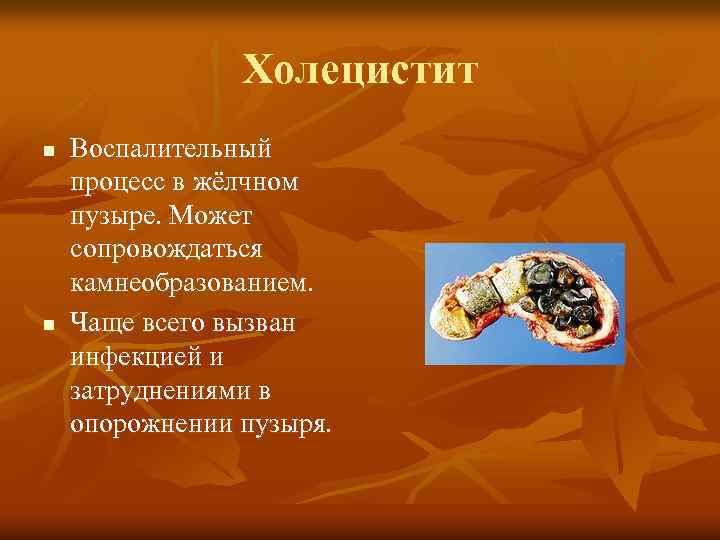 Холецистит n n Воспалительный процесс в жёлчном пузыре. Может сопровождаться камнеобразованием. Чаще всего вызван