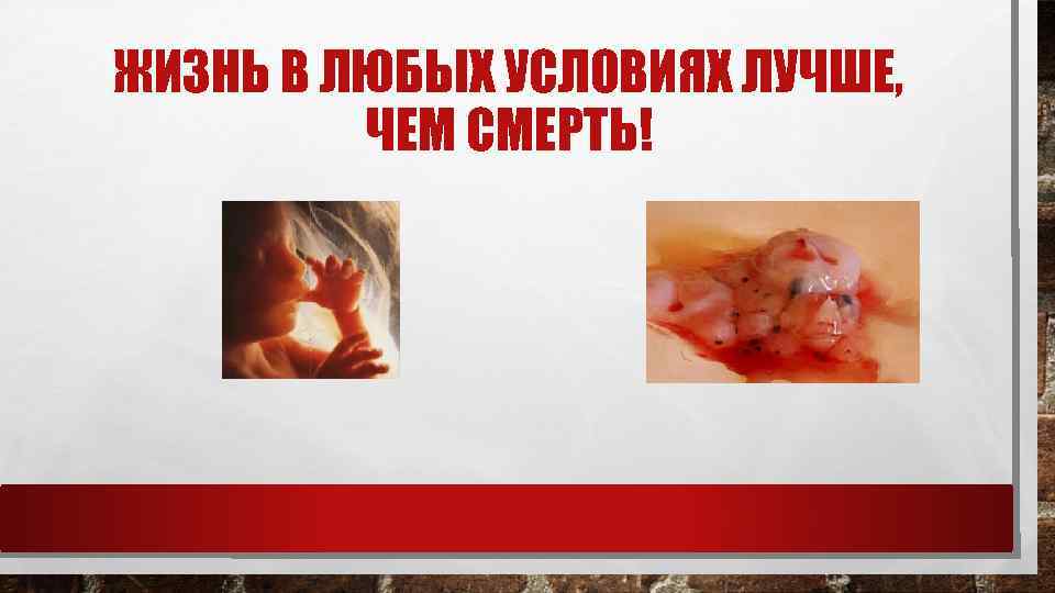 ЖИЗНЬ В ЛЮБЫХ УСЛОВИЯХ ЛУЧШЕ, ЧЕМ СМЕРТЬ! 