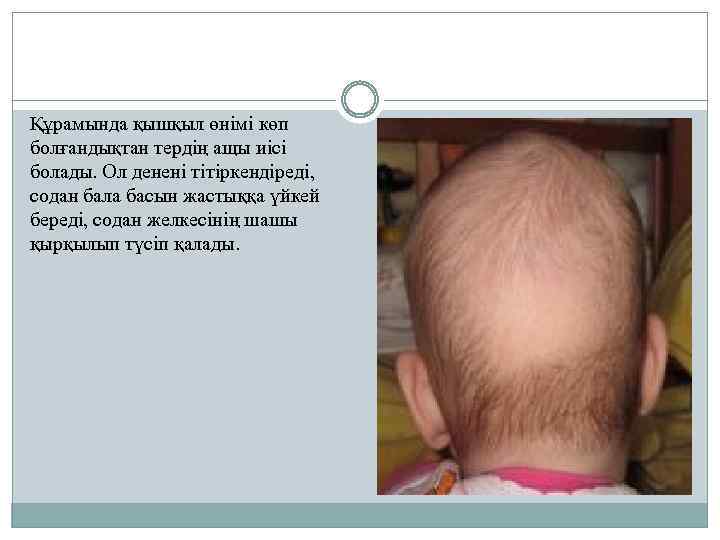 Құрамында қышқыл өнімі көп болғандықтан тердің ащы иісі болады. Ол денені тітіркендіреді, содан бала