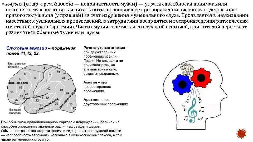 § Амузия (от др. греч. ἀμουσία — непричастность музам) — утрата способности понимать или