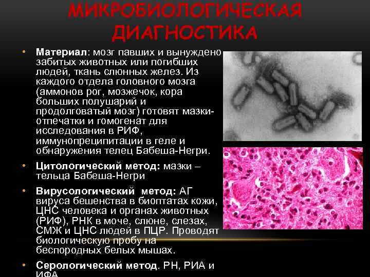 МИКРОБИОЛОГИЧЕСКАЯ ДИАГНОСТИКА • Материал: мозг павших и вынуждено забитых животных или погибших людей, ткань