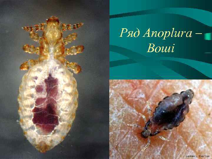 Ряд Anoplura – Воші 