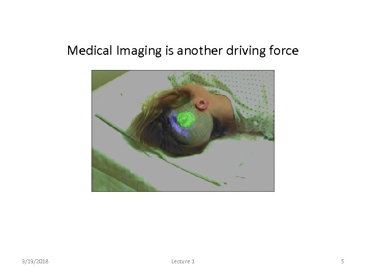 Medical Imaging is another driving force 3/19/2018 Lecture 1 5 