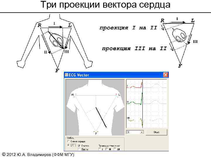 Три проекции вектора сердца © 2012 Ю. А. Владимиров (ФФМ МГУ) 