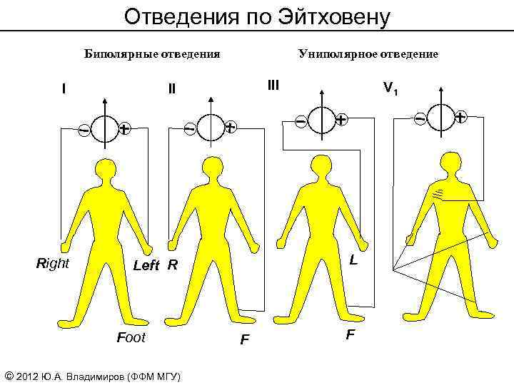 Отведения по Эйтховену Биполярные отведения I II Right Униполярное отведение Left R Foot ©