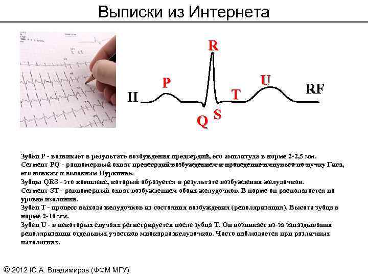 Зубец т в норме