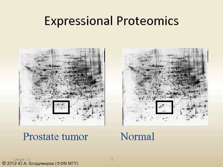 Expressional Proteomics Prostate tumor Lecture 1. 0 © 2012 Ю. А. Владимиров (ФФМ МГУ)