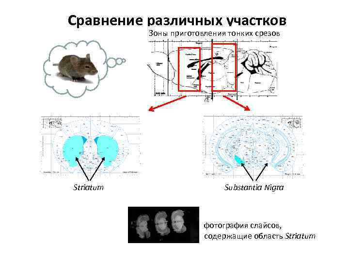 Сравнение различных участков Зоны приготовления тонких срезов мозга Striatum Substantia Nigra фотография слайсов, содержащие