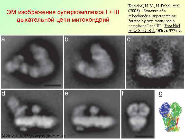 ЭМ изображения суперкомплекса I + III дыхательной цепи митохондрий © 2012 Ю. А. Владимиров