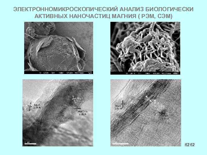 ЭЛЕКТРОННОМИКРОСКОПИЧЕСКИЙ АНАЛИЗ БИОЛОГИЧЕСКИ АКТИВНЫХ НАНОЧАСТИЦ МАГНИЯ ( РЭМ, СЭМ) 62 62 