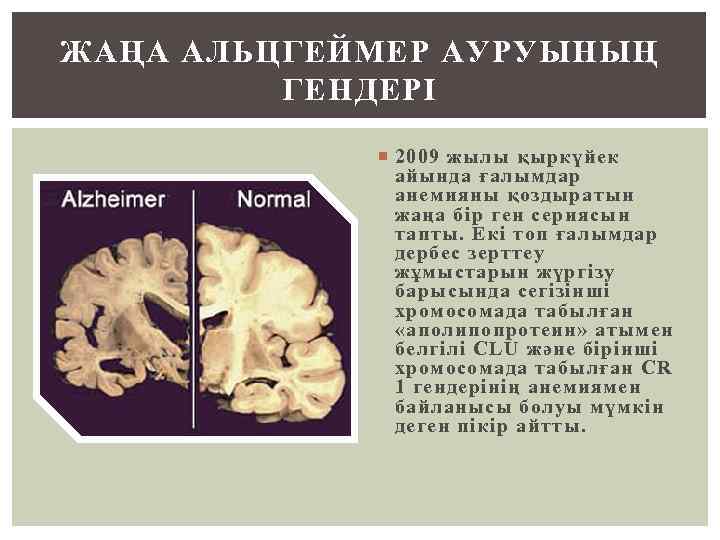 ЖАҢА АЛЬЦГЕЙМЕР АУРУЫНЫҢ ГЕНДЕРІ 2009 жылы қыркүйек айында ғалымдар анемияны қоздыратын жаңа бір ген