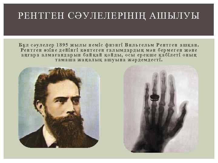 РЕНТГЕН СӘУЛЕЛЕРІНІҢ АШЫЛУЫ Бұл сәулелер 1895 жылы неміс физигі Вильгельм Рентген ашқан. Рентген өзіне