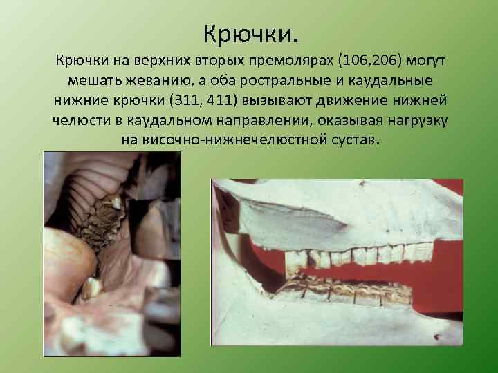 Крючки. Крючки на верхних вторых премолярах (106, 206) могут мешать жеванию, а оба ростральные