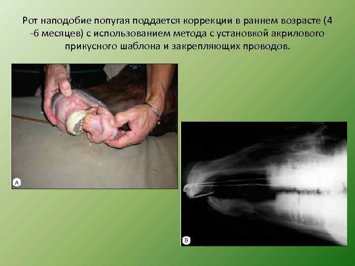 Рот наподобие попугая поддается коррекции в раннем возрасте (4 -6 месяцев) с использованием метода