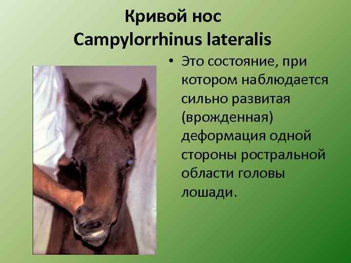 Кривой нос Campylorrhinus lateralis • Это состояние, при котором наблюдается сильно развитая (врожденная) деформация