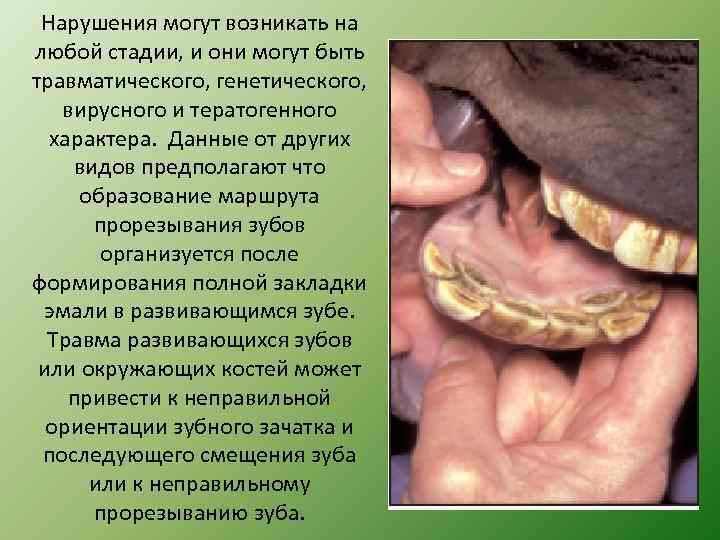 Нарушения могут возникать на любой стадии, и они могут быть травматического, генетического, вирусного и