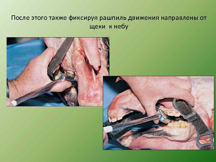 После этого также фиксируя рашпиль движения направлены от щеки к небу 