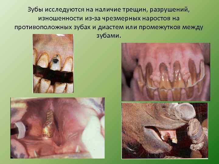 Зубы исследуются на наличие трещин, разрушений, изношенности из-за чрезмерных наростов на противоположных зубах и
