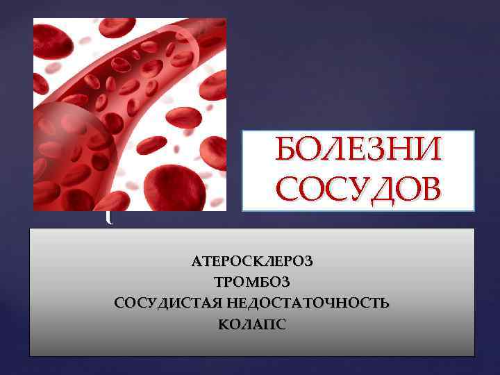 Заболевание сосудов. Болезни сосудов презентация. Васкулярная недостаточность в сосудах.