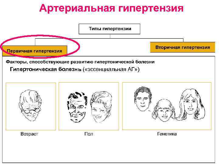 Артериальная гипертензия Гипертоническая болезнь ( «эссенциальная АГ» ) 
