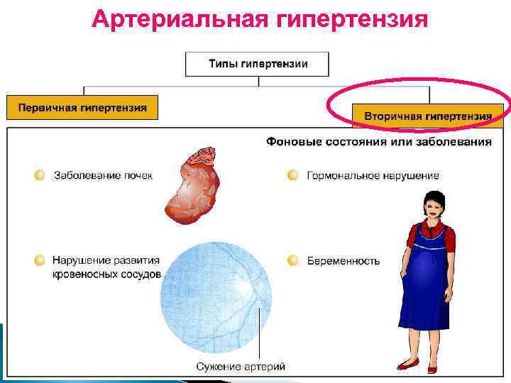 Артериальная гипертензия 