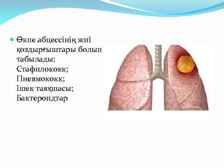  Өкпе абцессінің жиі қоздырғыштары болып табылады: Стафилококк; Пневмококк; Ішек таяқшасы; Бактероидтар 
