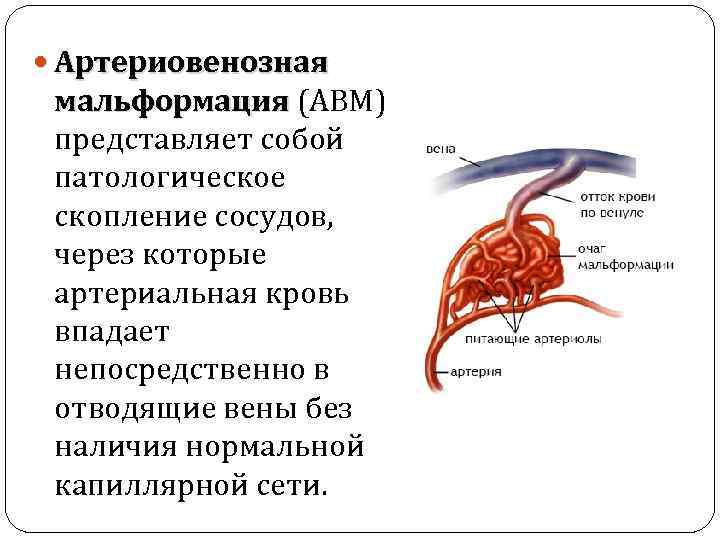 Венозная мальформация фото