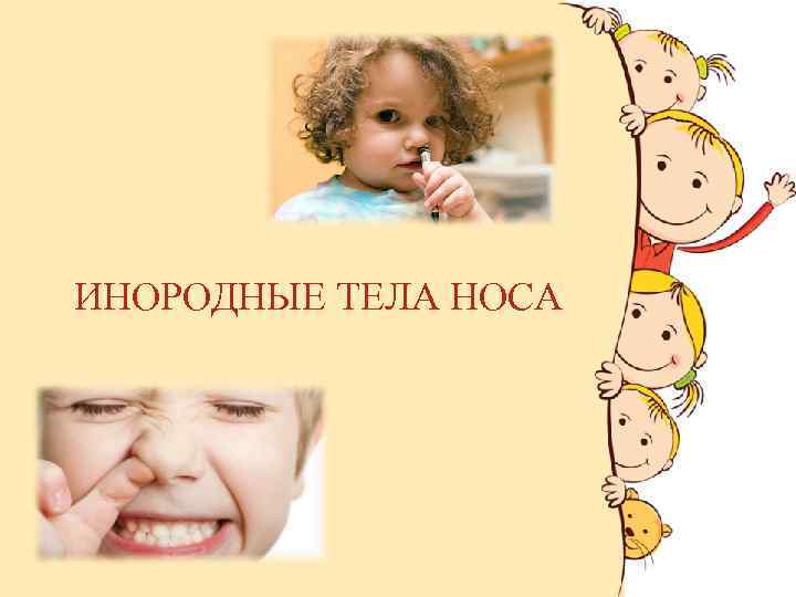 ИНОРОДНЫЕ ТЕЛА НОСА : 