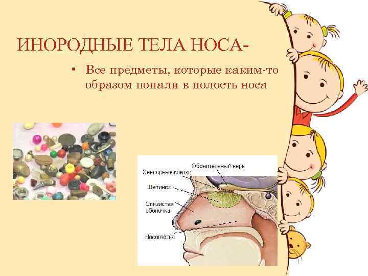 ИНОРОДНЫЕ ТЕЛА НОСА- • Все предметы, которые каким-то образом попали в полость носа :