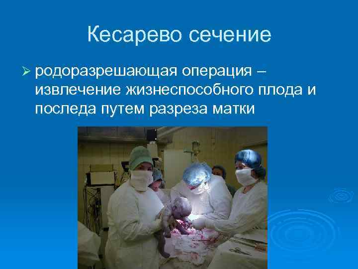 Кесарево сечение Ø родоразрешающая операция – извлечение жизнеспособного плода и последа путем разреза матки