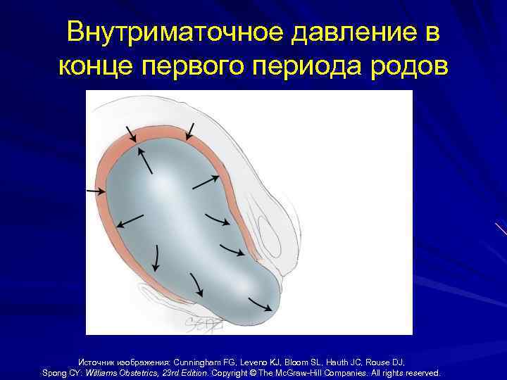 Внутриматочное давление в конце первого периода родов Источник изображения: Cunningham FG, Leveno KJ, Bloom