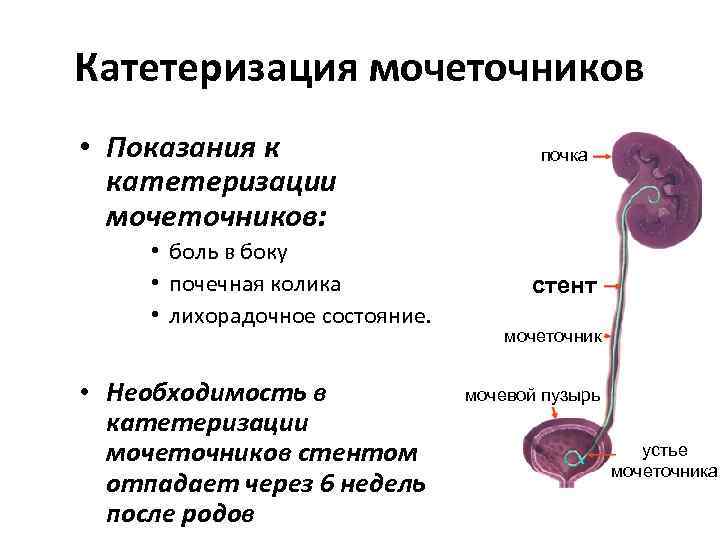 Как проходит мочеточник