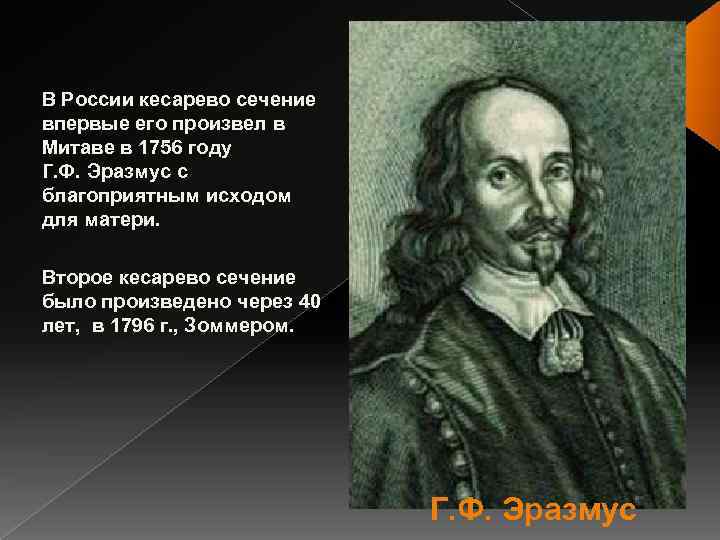 В России кесарево сечение впервые его произвел в Митаве в 1756 году Г. Ф.