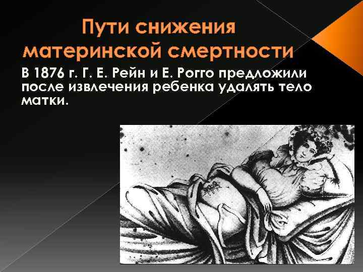 Пути снижения материнской смертности В 1876 г. Г. Е. Рейн и Е. Рогго предложили