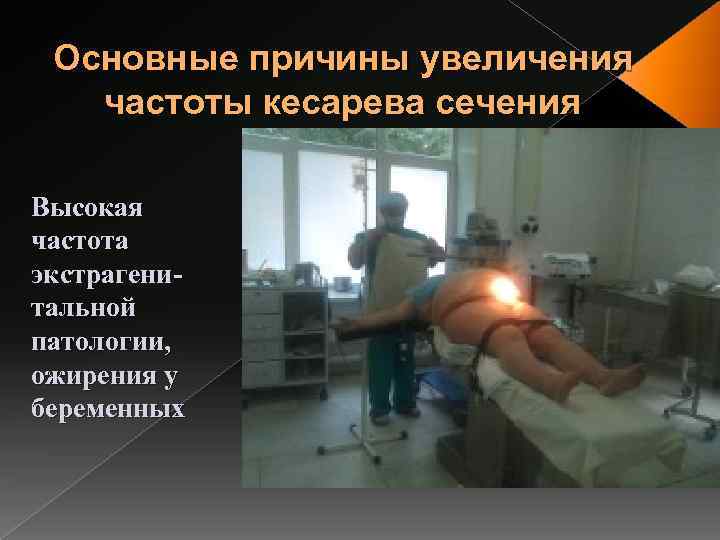 Основные причины увеличения частоты кесарева сечения Высокая частота экстрагенитальной патологии, ожирения у беременных 